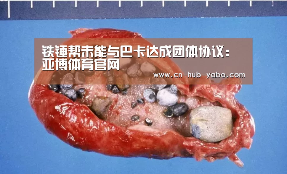 铁锤帮未能与巴卡达成团体协议:亚博体育官网(图2) 亚博体育官网
